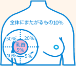 乳がんのできやすいところ